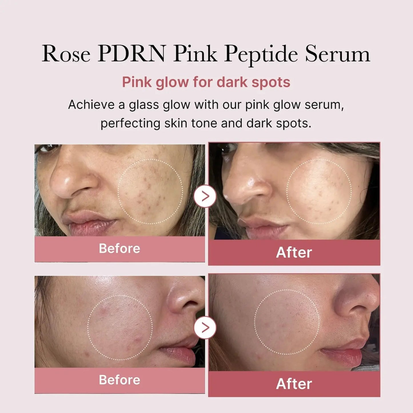 PDRN Pink Peptide Serum — Experience visible renewal in just 7 days