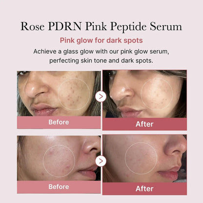 PDRN Pink Peptide Serum — Experience visible renewal in just 7 days